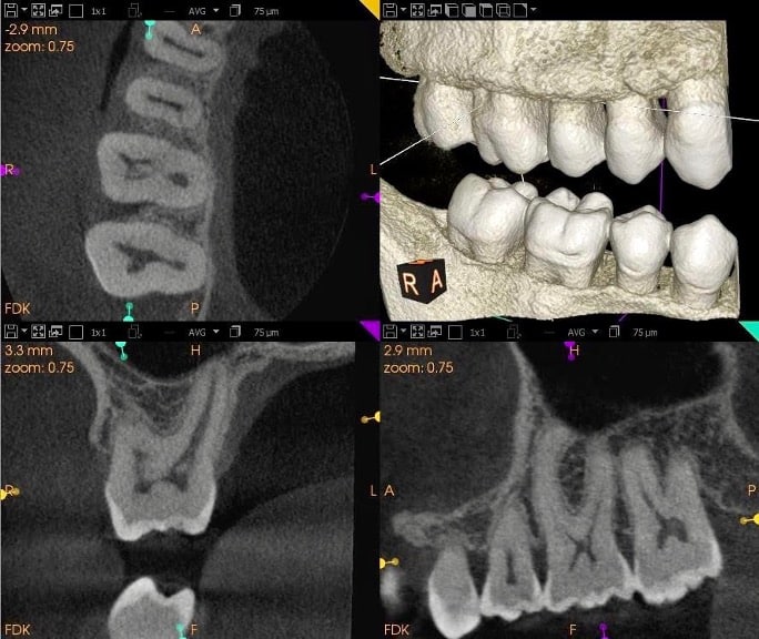 Cone Beam Technology Miami