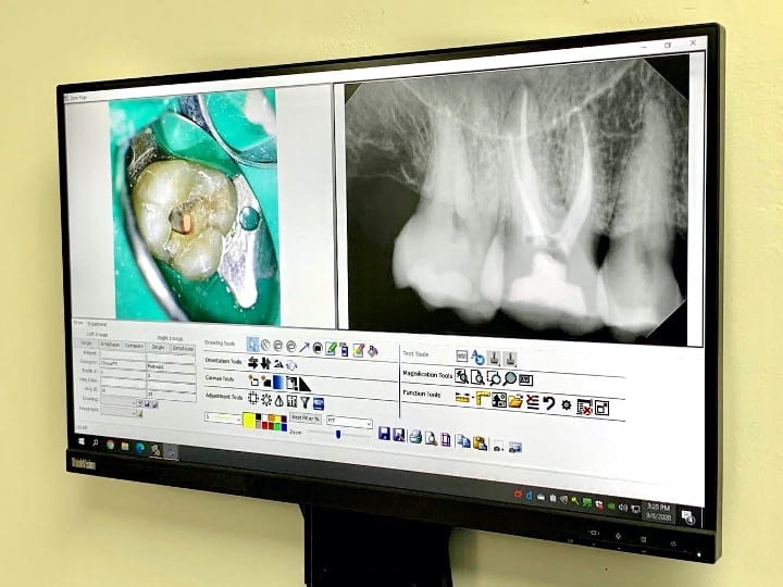 Digital Radiographs Miami